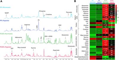 Prostate fibroblasts and prostate cancer associated fibroblasts exhibit different metabolic, matrix degradation and PD-L1 expression responses to hypoxia